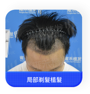 Back Image 2